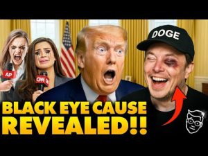Read more about the article Elon Appears in Oval Office with Black Eye, Leaves Reporters Stunned