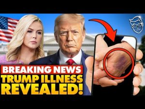 Read more about the article White House Spins Trump’s Health After Viral ‘Brusing’ Photos